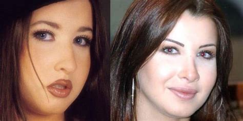 nancy ajram|nancy ajram before surgery.